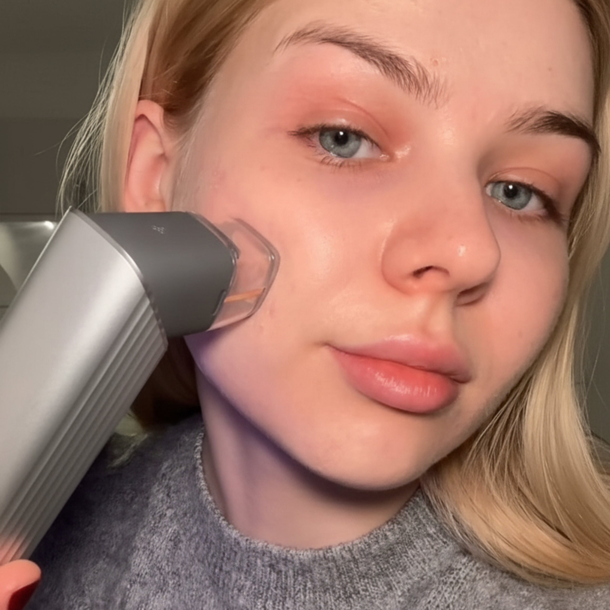 FORSCI. Cold Plasma Beauty Wand